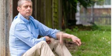 Tuvo su pene en el brazo por 6 años y ahora se lo pusieron en el lugar correcto: “Me siento un hombre de verdad”