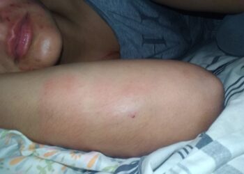Itatí: Jefe de Tránsito fue detenido tras darle feroz golpiza a su ex pareja