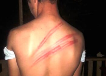 Una mujer agarró a latigazos a un compañerito de su hija: “Fuera de mi casa”