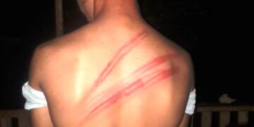 Una mujer agarró a latigazos a un compañerito de su hija: “Fuera de mi casa”