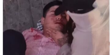 Resistencia: atacaron salvajemente a un joven afuera de un boliche