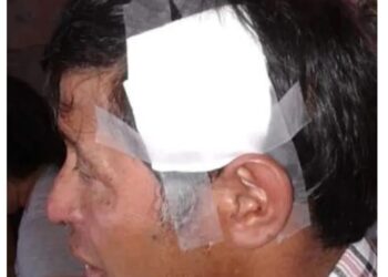Empleado municipal fue brutalmente golpeado por cuatro personas
