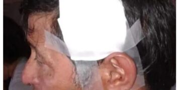 Empleado municipal fue brutalmente golpeado por cuatro personas