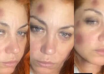 Golpes y moretones: la acusación de violencia de género de una ex Bandana