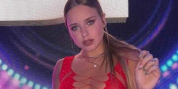 Coti de Gran Hermano se hizo otro retoque estético en el rostro