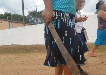 Una mujer entró durante la noche a la casa de su ex y le cortó la cara a su exsuegra con un machete