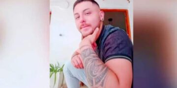 México: Cordobés fue internado de gravedad por viruela del mono