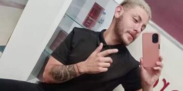 Murió el argentino que contrajo viruela del mono en México