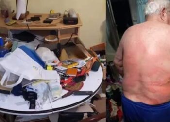 Brutal entradera: torturaron a un jubilado con agua hirviendo para robarle