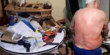 Brutal entradera: torturaron a un jubilado con agua hirviendo para robarle