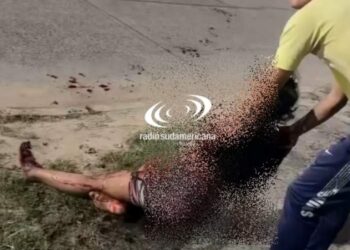 Terrible accidente entre dos motos provocó que una joven pierda el brazo