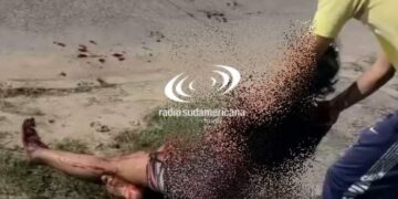 Joven que perdió el brazo denunció que piden dinero en su nombre