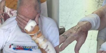 Terrorífica entradera: torturaron a jubilado y casi lo electrocutan