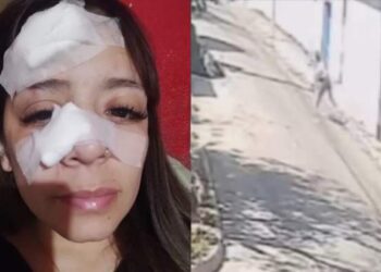 Una mujer se negó a darles comida a dos personas y le fracturaron la nariz con una piedra