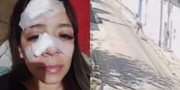 Una mujer se negó a darles comida a dos personas y le fracturaron la nariz con una piedra