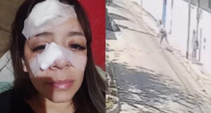 Una mujer se negó a darles comida a dos personas y le fracturaron la nariz con una piedra