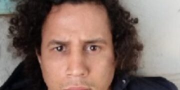 Un narco brasileño se puso pómulos para escapar de la justicia