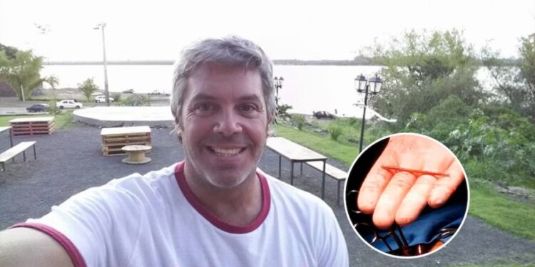 Correntino tragó un escarbadientes y se le atoró en el corazón