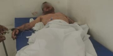 Un hombre desfiguró a golpes a su hijastra de 7 años: los vecinos casi lo linchan