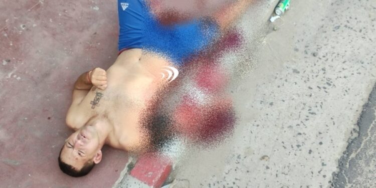 Goya: un carpincho le mordió el brazo y casi muere desangrado