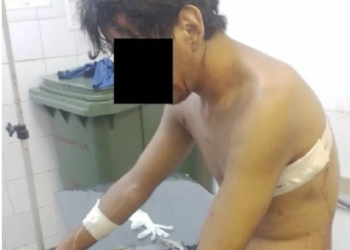 Dos hermanos resultaron acuchillados en una pelea entre familias en Corrientes