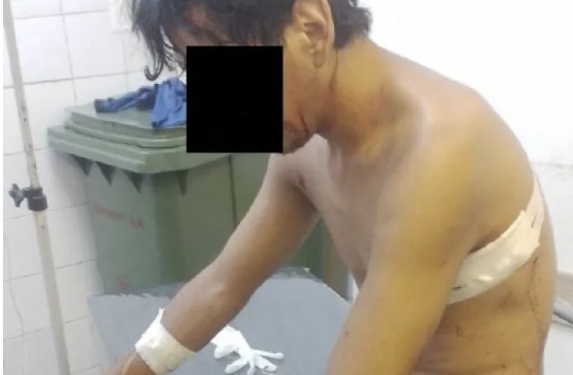 Dos hermanos resultaron acuchillados en una pelea entre familias en Corrientes