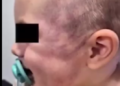 Un bebé de 8 meses fue brutalmente golpeado en un jardín de Córdoba