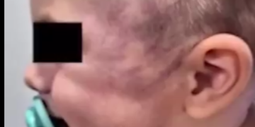 Un bebé de 8 meses fue brutalmente golpeado en un jardín de Córdoba