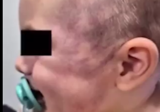 Un bebé de 8 meses fue brutalmente golpeado en un jardín de Córdoba